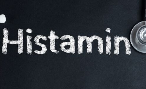Histamin İntoleransı
